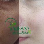 کلینیک زیبایی پوست و مو آرزو در اسدآباد