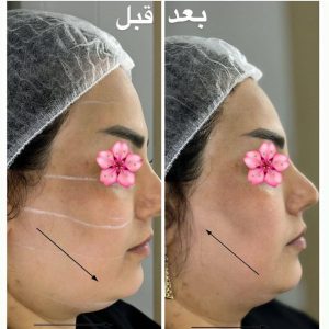 معرفی کلینیک زیبایی پوست و مو آرزو در اسدآباد در سامانه مشاغل ممتاز