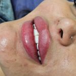 کلینیک تخصصی حجم دهی سینه و باسن بنیتا در شرق تهران