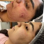 آموزش و خدمات تخصصی پاکسازی پوست دلارام مرادی در اراک