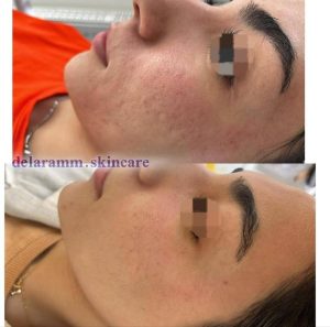  معرفی آموزش و خدمات تخصصی پاکسازی پوست دلارام مرادی در اراک در مشاغل ممتاز