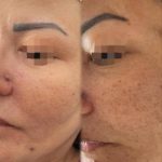 آموزش و خدمات تخصصی پاکسازی پوست دلارام مرادی در اراک