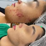 آموزش و خدمات تخصصی پاکسازی پوست دلارام مرادی در اراک