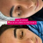 آموزش و خدمات تخصصی پاکسازی پوست نسترن مشتاقی در اراک