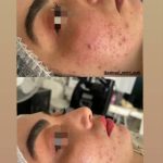 آموزش و خدمات تخصصی پاکسازی پوست نسترن مشتاقی در اراک