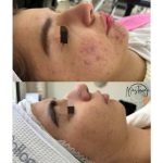 آموزش و خدمات تخصصی پاکسازی پوست نسترن مشتاقی در اراک