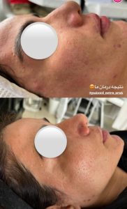 معرفی آموزش و خدمات تخصصی پاکسازی پوست نسترن مشتاقی در اراک در سامانه مشاغل ممتاز
