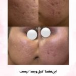 آموزش و خدمات تخصصی پاکسازی پوست نسترن مشتاقی در اراک