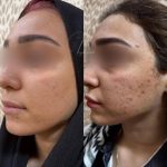 مرکز زیبایی پوست و مو نلا در تهران