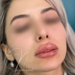 مرکز زیبایی پوست و مو نلا در تهران