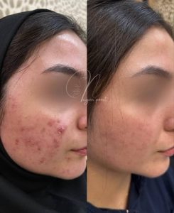 معرفی مرکز زیبایی پوست و مو نلا در تهران در سامانه مشاغل ممتاز