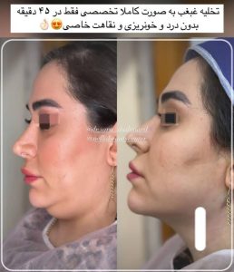 معرفی مرکز زیبایی پوست و مو نلا در تهران در سامانه مشاغل ممتاز