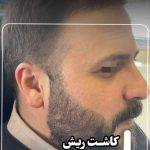 مرکز زیبایی پوست و مو نلا در تهران