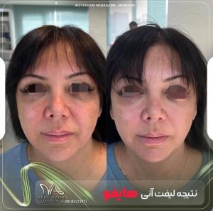 معرفی کلینیک پوست و مو ندا عظیمی در اراک در سامانه مشاغل ممتاز
