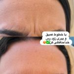 کلینیک زیبایی زیما رخ در تهران