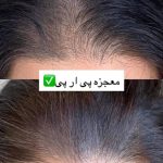 کلینیک زیبایی زیما رخ در تهران
