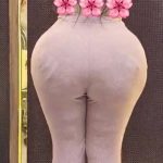 تزریق فیلر بادی باسن کلینیک بنیتا در شرق تهران