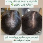 کلینیک زیبایی لوتس در یوسف آباد تهران