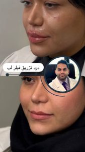 معرفی خدمات تزریق لب کلینیک لوتس تهران در مشاغل ممتاز