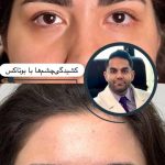 کلینیک زیبایی لوتس در یوسف آباد تهران