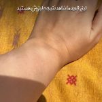 مرکز زیبایی لیزر رویان در اراک