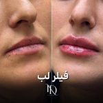 کلینیک لاغری زیبایی رایا در اراک