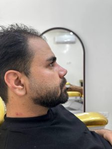 معرفی خدمات بوتاکس کلینیک زیبایی دکتر بیوتی  در مشاغل ممتاز