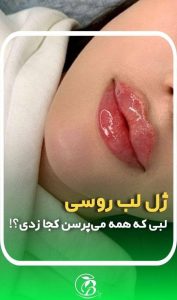 فیلر لب کلینیک بنیتا در شرق تهران در مشاغل ممتاز