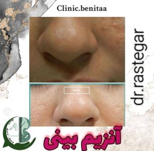 خدمات آنزیم بینی کلینیک بنیتا در مشاغل ممتاز