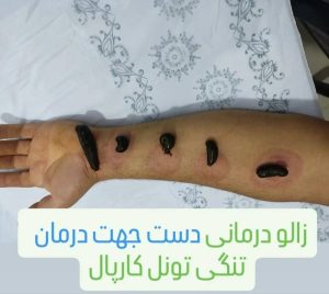 خدمات زالو درمانی مجموعه طب ایرانی نور در خمین در مشاغل ممتاز
