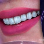 کلینیک دندانپزشکی روشا در کمالشهر