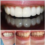 کلینیک دندانپزشکی روشا در کمالشهر