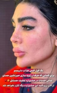 تزریق فول فیس کلینیک بنیتا در شرق تهران در مشاغل ممتاز