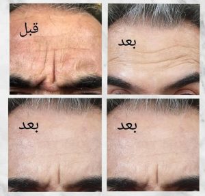 معرفی خدمات بوتاکس مرکز صدف در اسلامشهر در مشاغل ممتاز
