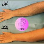 مرکز لیزر موهای زائد صدف در اسلامشهر