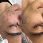 آموزش خدمات پاکسازی پوست آتنا حسینی در تهران