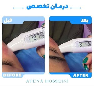 تمرین عملی پاکسازی پوست صورت با ابزار حرفه‌ای در کلاس آموزش آتنا حسینی-مشاغل ممتاز