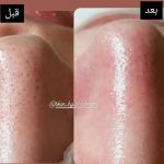 آموزش خدمات پاکسازی پوست شبنم دهبکری در مهاباد