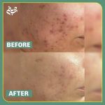 آموزش خدمات پاکسازی پوست شبنم دهبکری در مهاباد