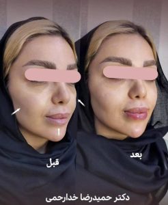 زاویه‌سازی و فرم‌دهی فک و صورت در کلینیک زیبایی دکتر حمیدرضا خدارحمی تهران - مشاغل ممتاز