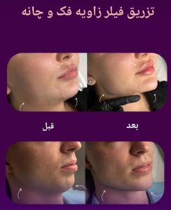  فرم‌دهی فک و صورت در کلینیک زیبایی دکتر حمیدرضا خدارحمی تهران - مشاغل ممتاز