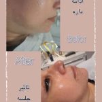 آموزش خدمات پاکسازی پوست شیوا خیراله‌پور در بابل