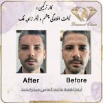 کلینیک زیبایی دایموند در شیراز