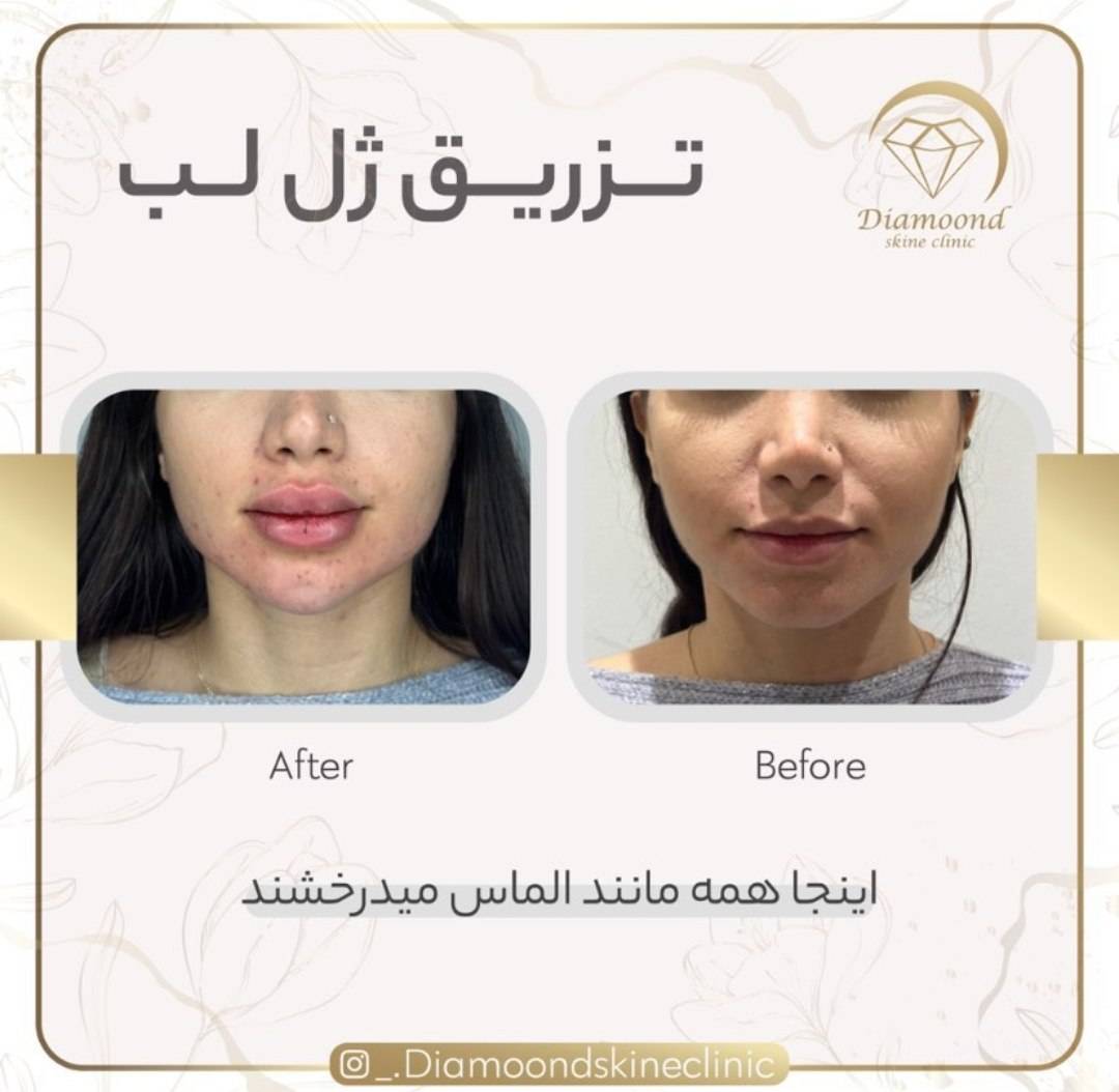 کلینیک زیبایی دایموند در شیراز؛ مرکز تخصصی فیلر، بوتاکس و لیفت صورت_مشاغل ممتاز