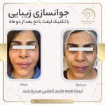 کلینیک زیبایی دایموند در شیراز