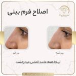 کلینیک زیبایی دایموند در شیراز