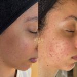 آموزش خدمات پاکسازی پوست و مو سارا محمدی در اصفهان