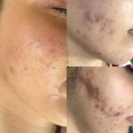 آموزش خدمات پاکسازی پوست و مو سارا محمدی در اصفهان