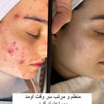 آموزش خدمات پاکسازی پوست و مو سارا محمدی در اصفهان
