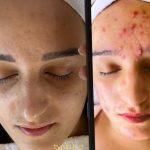 آموزش خدمات پاکسازی پوست و مو سارا محمدی در اصفهان